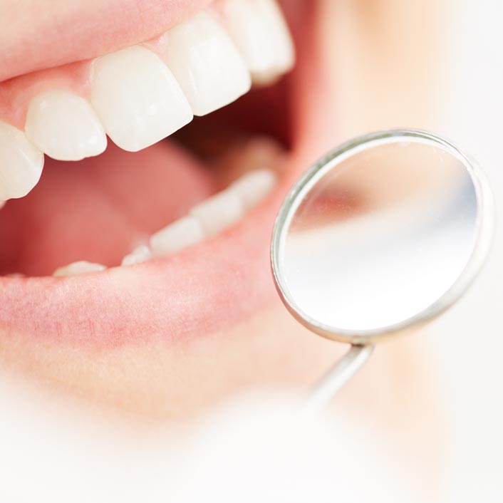 Oral Cancer Screening - Dental Services
